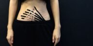 Is It My Back or My Belly? Sorting Out the Pain