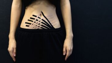 Is It My Back or My Belly? Sorting Out the Pain