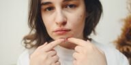 Real Talk: Does Creatine Actually Give You Acne?